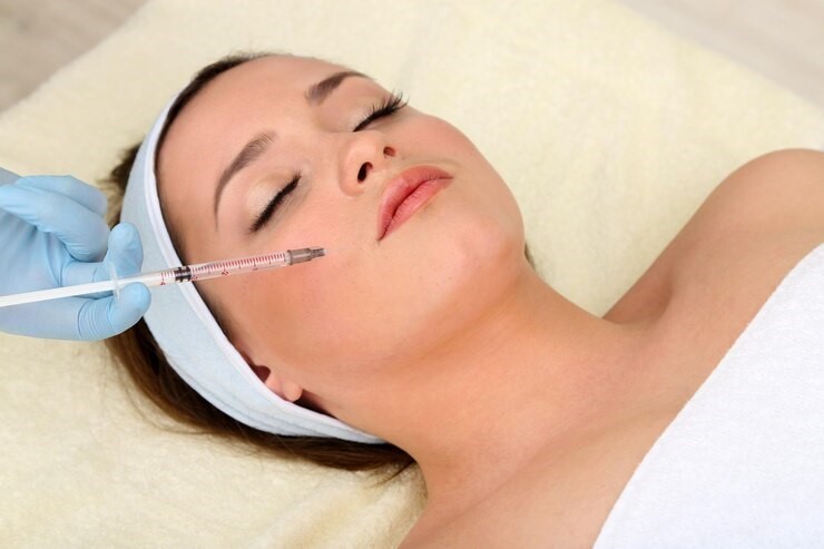 microneedling